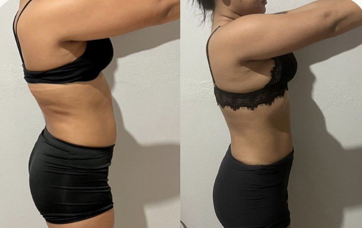 Resultado real de aluna 6 — antes e depois